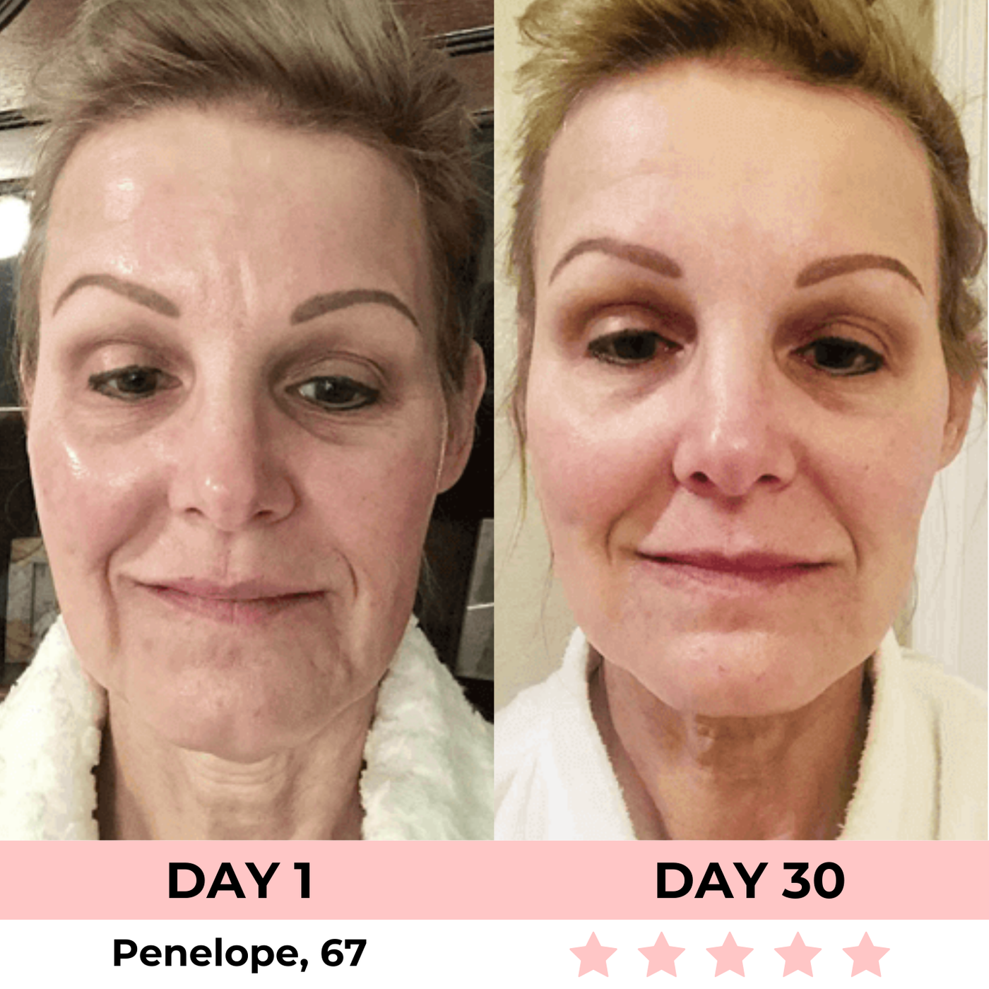 LumiLift LED Facial Sculptor