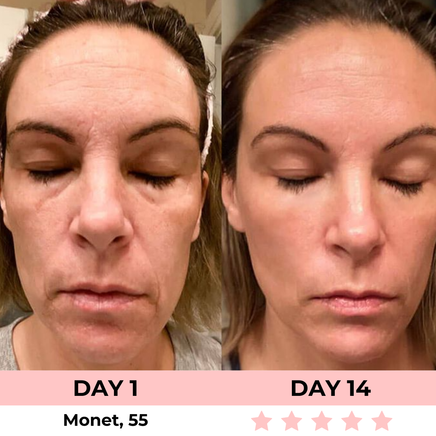 LumiLift LED Facial Sculptor