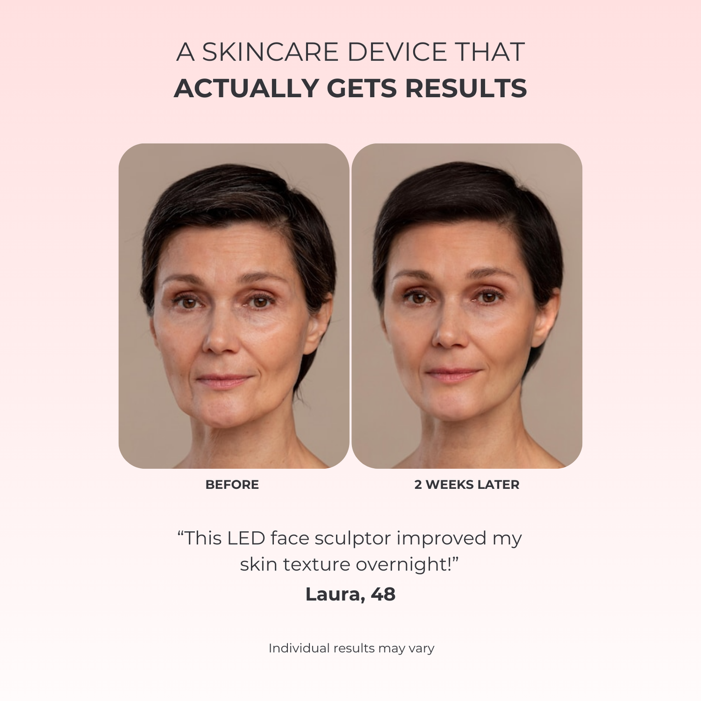 LumiLift LED Facial Sculptor