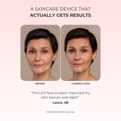 LumiLift LED Facial Sculptor