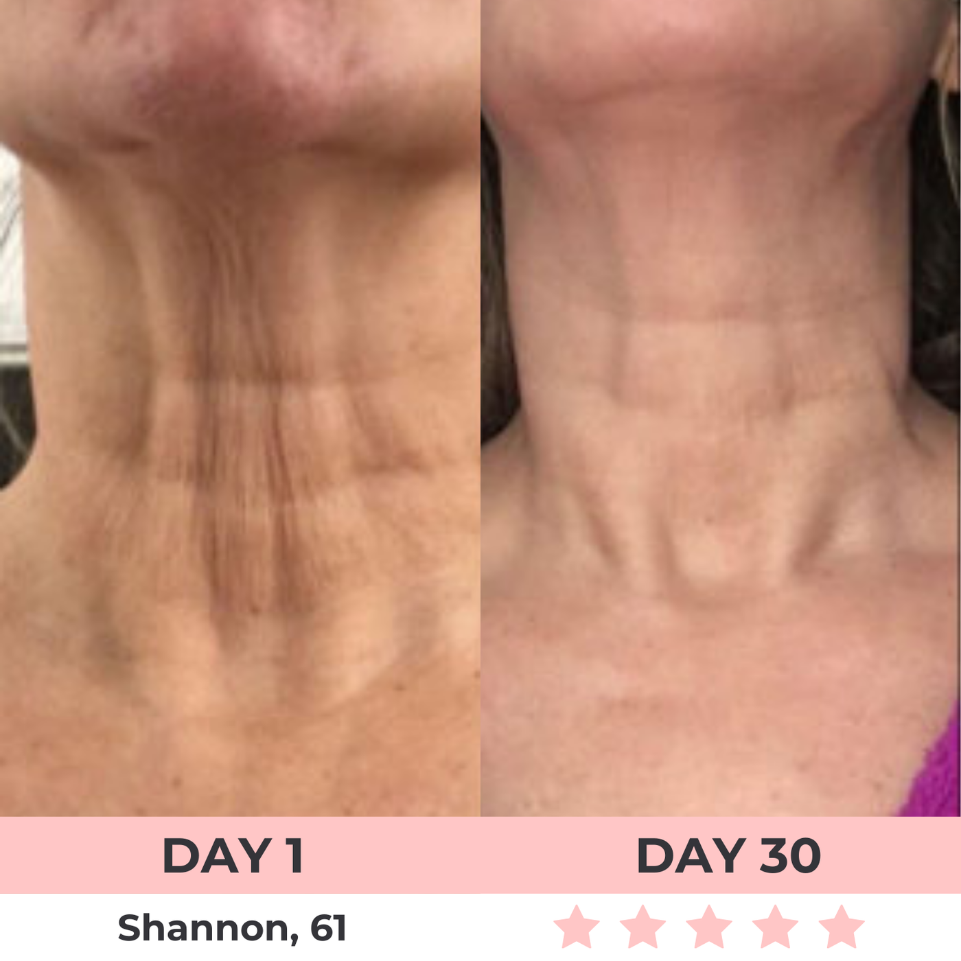 LumiLift LED Facial Sculptor