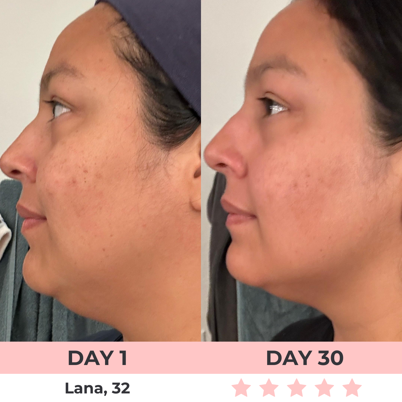 LumiLift LED Facial Sculptor