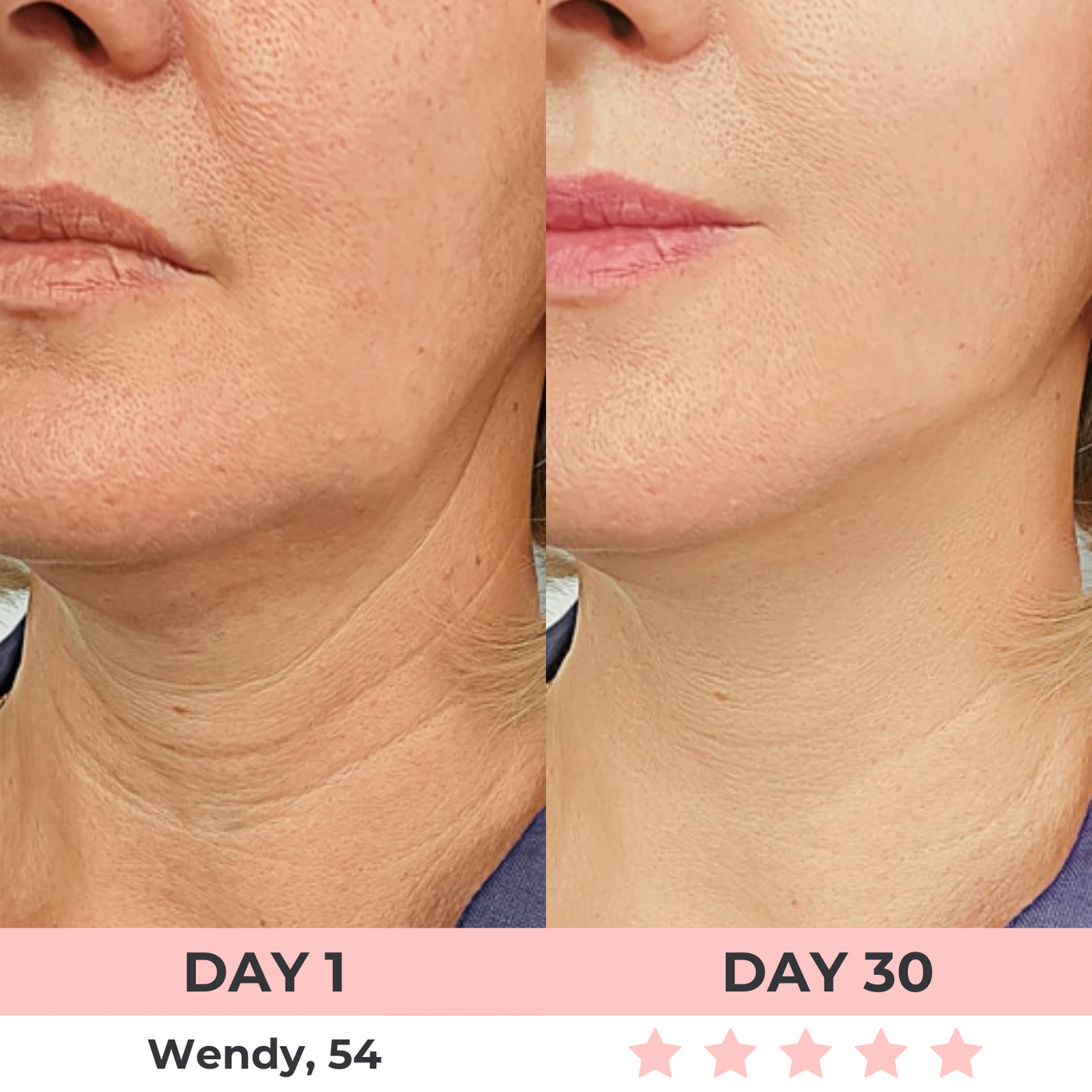 LumiLift LED Facial Sculptor
