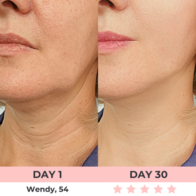 LumiLift LED Facial Sculptor
