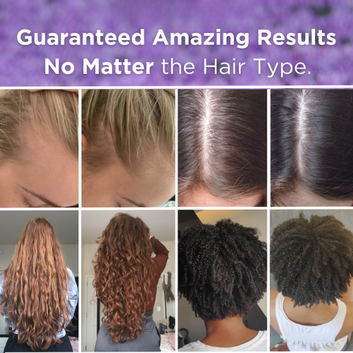 BluumBrush™ 4-in-1 Brush + Limited Free Hair Growth Oil.